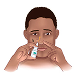 Nasal Pump Sprays