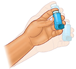 How to Use Metered-Dose Inhalers