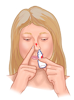 Nasal spray hot sale medication